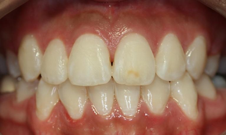 Orthodontics-After-Image