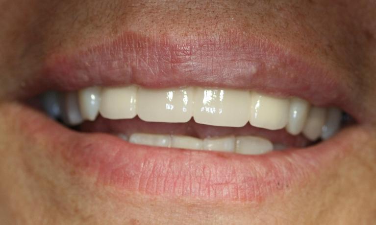 Cosmetic-Case-After-Image