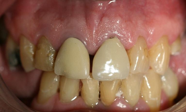 Cosmetic-Dentistry-Before-Image