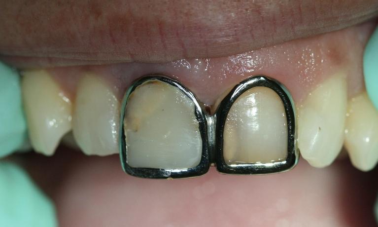 Cosmetic-Case-Before-Image