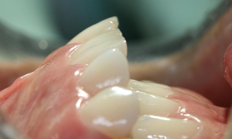 Orthodontics-Case-Before-Image